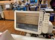 PHILIPS Allura Xper FD20 Cath Lab