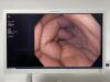 OLYMPUS GIF- HQ190 Endoscope