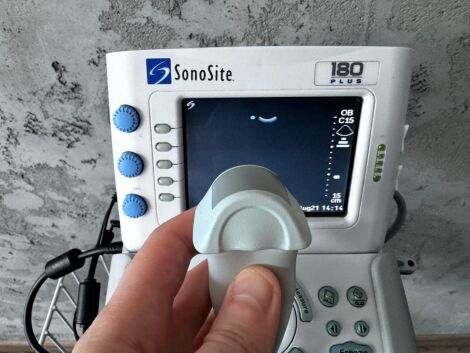 SONOSITE 180 Plus with Linear & Convex Ultrasound General