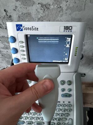 SONOSITE 180 Plus with Linear & Convex Ultrasound General