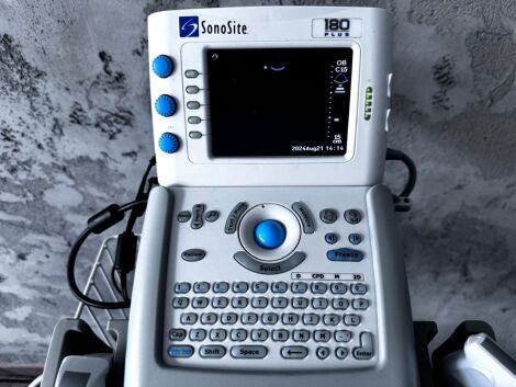 SONOSITE 180 Plus with Linear & Convex Ultrasound General