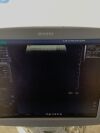 SIEMENS Acuson Antares 