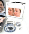 SCITON JOULE Laser - IPL