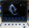 GE Vivid i Monitor