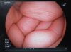 FUJIFILM EG-530NW Endoscope
