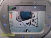 CONMED CORPORATION Conmed 60-9500-120 Altrus Thermal Tissue