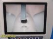 VERATHON 0570-0338 Glidescope Titanium Video Monitor