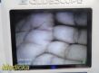 VERATHON 0570-0338 Glidescope Titanium Video Monitor