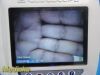 VERATHON 0570-0338 Glidescope Titanium Video Monitor