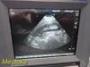 SONOSITE 2005  C15 / 4-2 MHz Curved Array Ultrasound Transducer
