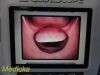 VERATHON 2015  0570-0338 Glidescope Titanium Video Monitor