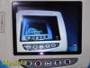 VERATHON 2015  0570-0338 Glidescope Titanium Video Monitor
