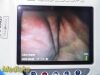 VERATHON 2015  0570-0338 Glidescope Titanium Video Monitor