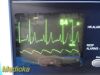 WELCH ALLYN 6200 Series W/ ECG,SpO2,NBP Leads, Printer ~ Patient Monitor