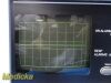 WELCH ALLYN Protocol Inc 6200 Series Patient Monitor