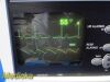 WELCH ALLYN Protocol Inc 6200 Series Patient Monitor