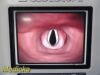 VERATHON 2015  0570-0338 Glidescope Titanium Video Monitor