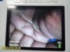 VERATHON 2015  0570-0338 Glidescope Titanium Video Monitor