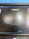 ALPINION ECUBE8 Ultrasound - OB / GYN