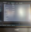 ALPINION ECUBE8 Ultrasound - OB / GYN