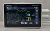 MINDRAY BeneVision N1 Patient Monitor W/ Masimo SpO2, NIBP, 3-Lead NIBP, Resp &amp; Temp - 188816 Monitor