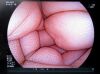 FUJIFILM EG-590WR2 Endoscope