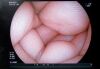 FUJIFILM EG-L580NW7 Endoscope