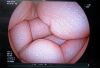 FUJIFILM EG-580NW2 Endoscope