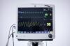 GE Carescape B650 EKG Monitor