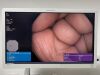 OLYMPUS CF-HQ190L Endoscope