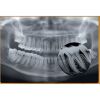 VATECH PAX-PRIMO Dental X-Ray
