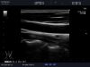 ALOKA UST-5413 Ultrasound Transducer