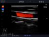 ALOKA UST-5413 Ultrasound Transducer