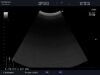 ALOKA UST-9123 Ultrasound Transducer