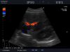 ALOKA UST-9123 Ultrasound Transducer