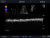 ALOKA UST-9123 Ultrasound Transducer