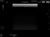 HITACHI EUP-L65 Ultrasound Transducer
