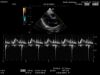 HITACHI EUP-S70 Ultrasound Transducer