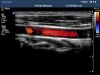 PHILIPS L12-5 Ultrasound Transducer