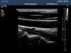 PHILIPS L9-3 Ultrasound Transducer