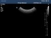 PHILIPS C8-5 Ultrasound Transducer