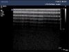 PHILIPS L15-7i0 Ultrasound Transducer