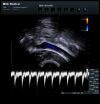 BK MEDICAL 8808 Ultrasound Transducer