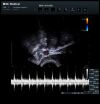 BK MEDICAL 8808 Ultrasound Transducer