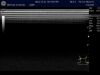 GE ML6-15-D Ultrasound Transducer