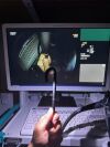 FUJINON EG760R Gastroscope