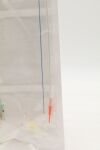 SILK SR-4F21G7D-MP | | EXPIRED | BOX OF 10 | Road Medical Enhance Transcarotid/Peripheral Access Kit 4F