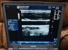 GE HEALTHCARE LOGIQ Logiq e BT11