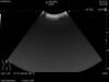 HITACHI C25P Ultrasound Transducer