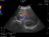 HITACHI C25P Ultrasound Transducer
